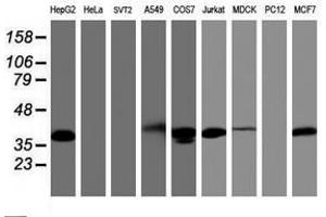 Image no. 3 for anti-PDZ and LIM Domain 2 (PDLIM2) antibody (ABIN1500130) (PDLIM2 Antikörper)