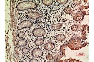 Immunohistochemistry (IHC) analysis of paraffin-embedded Human Colon, antibody was diluted at 1:100. (LIF Antikörper  (C-Term))