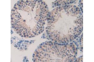Used in DAB staining on fromalin fixed paraffin- embedded testis tissue (TESK1 Antikörper  (AA 52-309))