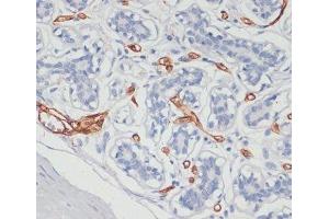 Immunohistochemistry of paraffin-embedded Human breast using CD36 Polyclonal Antibody at dilution of 1:200 (40x lens). (CD36 Antikörper)