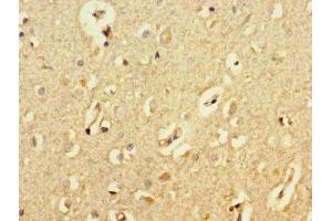 Immunohistochemistry of paraffin-embedded human brain tissue using ABIN7145091 at dilution of 1:100 (ATG5 Antikörper  (AA 5-272))