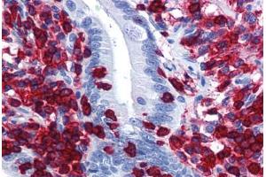 anti-Coronin, Actin Binding Protein, 1A (CORO1A) (AA 360-462) antibody