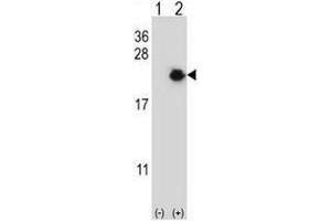 Western blot analysis of EIF4EBP1 (arrow) using rabbit polyclonal EIF4EBP1 Antibody (Center) . (eIF4EBP1 Antikörper  (Middle Region))