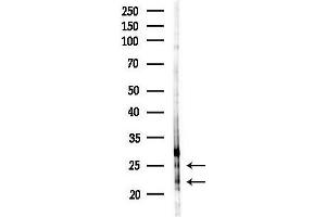 anti-Claudin 20 (CLDN20) (C-Term) antibody