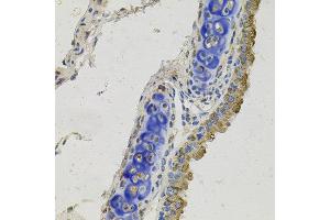 Immunohistochemistry of paraffin-embedded mouse lung using GAS6 antibody at dilution of 1:100 (x40 lens). (GAS6 Antikörper)