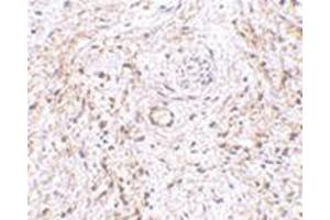 Immunohistochemistry of TEM5 in human bladder tissue with this product at 5 μg/ml. (GPR124 Antikörper  (Center))