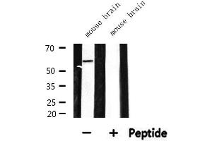 Western blot analysis of extracts from mouse brain, using CDKAL Antibody.