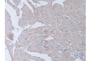 Immunohistochemistry (IHC) image for anti-Interferon gamma (IFNG) (AA 23-156) antibody (ABIN7429433)