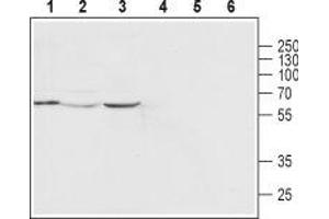 Western blot analysis of human MCF-7 breast adenocarcinoma cell line (lanes 1 and 4), rat heart (lanes 2 and 5) and mouse heart (lanes 3 and 6) lysates: - 1-3. (Mucolipin 2 (MCOLN2) (AA 212-228), (Intracellular), (N-Term) Antikörper)