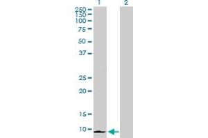 Western Blot analysis of CXCL6 expression in transfected 293T cell line by CXCL6 MaxPab polyclonal antibody. (CXCL6 Antikörper  (AA 1-114))