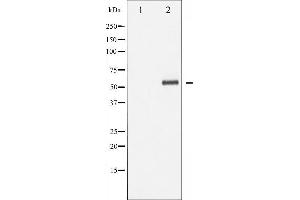 Western Blotting (WB) image for anti-Docking Protein 1, 62kDa (Downstream of tyrosine Kinase 1) (DOK1) (pTyr362) antibody (ABIN6256717)