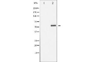 Western blot analysis of p62 Dok phosphorylation expression in Jurkat whole cell lysates,The lane on the left is treated with the antigen-specific peptide. (DOK1 Antikörper  (pTyr362))