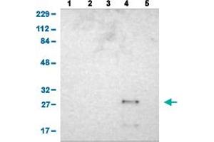 Western Blot analysis of (1) human cell line RT-4 (2) human cell line U-251MG sp (3) human plasma (IgG/HSA depleted) (4) human liver tissue, and (5) human tonsil tissue. (ASB6 Antikörper  (AA 10-133))