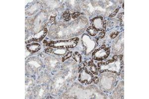 Immunohistochemical staining of human kidney with CLMN polyclonal antibody  shows strong membranous positivity in cells in tubules. (CLMN Antikörper)