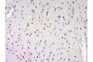 Formalin-fixed and paraffin embedded rat brain labeled with Anti-ProSAPiP1 Polyclonal Antibody, Unconjugated  at 1:200 followed by conjugation to the secondary antibody and DAB staining (ProSAPiP1 Antikörper  (AA 151-250))