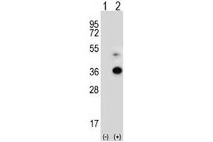 Western Blotting (WB) image for anti-Angiopoietin-Like 7 (ANGPTL7) (AA 300-350) antibody (ABIN3028462)