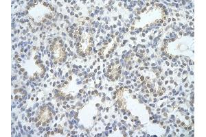 Rabbit Anti-EXOSC2 antibody   Paraffin Embedded Tissue: Human Lung cell Cellular Data: alveolar cell of renal tubule Antibody Concentration: 4. (EXOSC2 Antikörper  (N-Term))