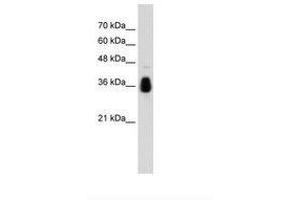 Image no. 1 for anti-Makorin Ring Finger Protein 1 (MKRN1) (AA 371-420) antibody (ABIN203525) (MKRN1 Antikörper  (AA 371-420))