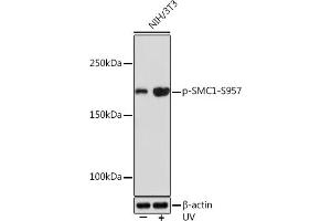 Western blot analysis of extracts of NIH/3T3 cells, using Phospho-SMC1-S957 Rabbit mAb (ABIN7270613) at 1:1000 dilution. (SMC1A Antikörper  (pSer957))
