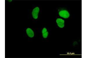 Immunofluorescence of purified MaxPab antibody to GTF3C5 on HeLa cell.