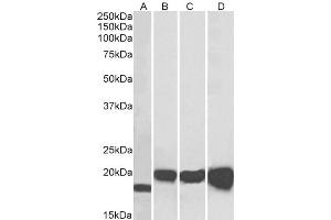 ABIN190907 (0. (SOD1 Antikörper  (Internal Region))