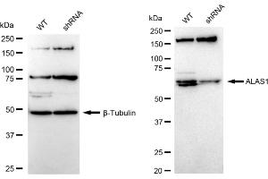 Western blotting analysis using ALAS1 antibody (ABIN7797590). (Rekombinanter ALAS1 Antikörper)