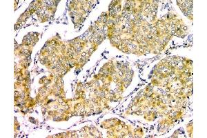 IHC analysis of GM130 using anti-GM130 antibody (ABIN6719433). (Golgin A2 (GOLGA2) (AA 796-913) Antikörper)
