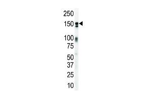 Western blot analysis of anti-ErbB3 Pab (ABIN391949 and ABIN2841747) in mouse brain lysate. (ERBB3 Antikörper  (N-Term))