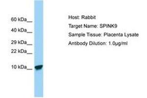 Image no. 1 for anti-Serine Peptidase Inhibitor, Kazal Type 9 (SPINK9) (C-Term) antibody (ABIN6750139) (SPINK9 Antikörper  (C-Term))