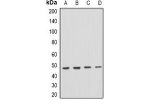 Western blot analysis of PSTPIP1 expression in THP1 (A), mouse spleen (B), mouse brain (C), rat brain (D) whole cell lysates. (PSTPIP1 Antikörper)