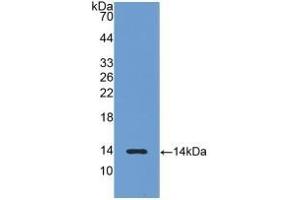 Detection of Recombinant LHb, Rat using Polyclonal Antibody to Luteinizing Hormone Beta Polypeptide (LHb) (LHB Antikörper  (AA 21-141))