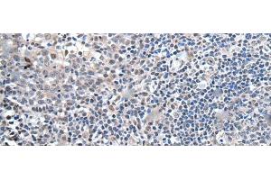 Immunohistochemistry of paraffin-embedded Human tonsil tissue using ZBTB10 Polyclonal Antibody at dilution of 1:100(x200) (ZBTB10 Antikörper)
