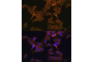 Immunofluorescence analysis of C6 cells using EIF2B2 antibody (ABIN6132131, ABIN6140037, ABIN6140038 and ABIN6222805) at dilution of 1:100. (EIF2B2 Antikörper  (AA 1-351))