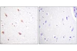 Immunohistochemistry analysis of paraffin-embedded human brain, using NIFK (Phospho-Thr234) Antibody.