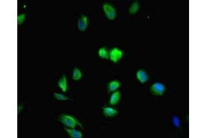 Immunofluorescent analysis of Hela cells using ABIN7159120 at dilution of 1:100 and Alexa Fluor 488-congugated AffiniPure Goat Anti-Rabbit IgG(H+L) (MED29 Antikörper  (AA 1-212))