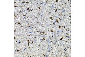 Immunohistochemistry of paraffin-embedded rat brain using TRP antibody (ABIN6133559, ABIN6149565, ABIN6149567 and ABIN6224668) at dilution of 1:100 (40x lens). (TRPA1 Antikörper  (AA 850-950))
