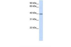 Image no. 1 for anti-Transcription Elongation Factor A (SII), 3 (TCEA3) (AA 108-157) antibody (ABIN6738373) (TCEA3 Antikörper  (AA 108-157))