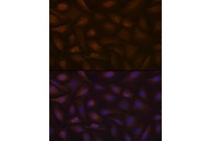 Immunofluorescence analysis of U-2 OS cells using KIF Rabbit mAb (ABIN7268120) at dilution of 1:100 (40x lens). (KIFAP3 Antikörper)