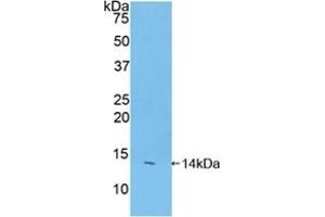 Detection of Recombinant FAM19A2, Mouse using Polyclonal Antibody to Family With Sequence Similarity 19, Member A2 (FAM19A2) (FAM19A2 Antikörper  (AA 31-119))