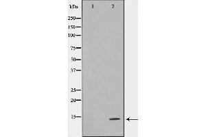 Western blot analysis on HeLa cell lysate using TUSC2 Antibody,The lane on the left is treated with the antigen-specific peptide. (TUSC2 Antikörper  (Internal Region))