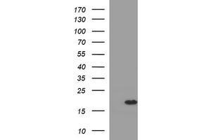 Western Blotting (WB) image for anti-Synuclein, alpha (SNCA) antibody (ABIN2716014) (SNCA Antikörper)