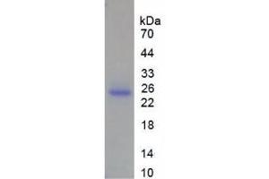 SDS-PAGE of Protein Standard from the Kit (Highly purified E. (MMP13 CLIA Kit)