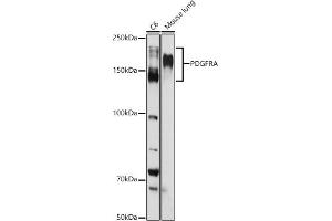 Western blot analysis of extracts of various cell lines, using PDGFRA antibody (ABIN3022920, ABIN3022921, ABIN3022922 and ABIN6219298) at 1:1000 dilution. (PDGFRA Antikörper  (AA 1-210))