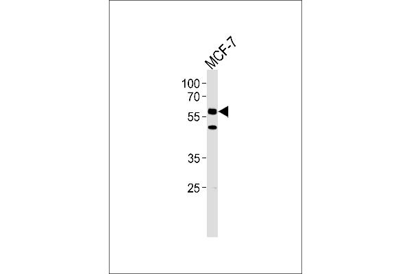 CDC7 Antikörper  (N-Term)