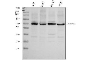 Western blot analysis of RPA70 using anti-RPA70 antibody (ABIN3044541).
