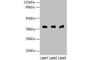 Western blot All lanes: MRNIP antibody at 4 μg/mL Lane 1: Mouse kidney tissue Lane 2: Mouse heart tissue Lane 3: Hela whole cell lysate Secondary Goat polyclonal to rabbit IgG at 1/10000 dilution Predicted band size: 38, 30, 32 kDa Observed band size: 38 kDa (MRN Complex-Interacting Protein (MRNIP) (AA 1-200) Antikörper)