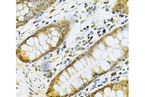 Immunohistochemistry (Paraffin-embedded Sections) (IHC (p)) image for anti-Phosphoglycerate Kinase 1 (PGK1) antibody (ABIN7008583)