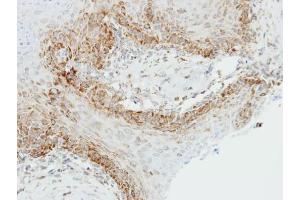 Immunohistochemistry (IHC) image for anti-alpha Ketoglutarate Dehydrogenase (alphaKGDHC) (C-Term) antibody (ABIN2856043)