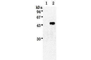 Western Blotting (WB) image for anti-Sialidase 3 (Membrane Sialidase) (Neu3) antibody (ABIN1449196)