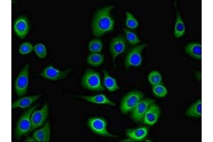 Immunofluorescent analysis of A549 cells using ABIN7146265 at dilution of 1:100 and Alexa Fluor 488-congugated AffiniPure Goat Anti-Rabbit IgG(H+L) (Tescalcin Antikörper  (AA 2-214))